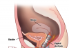 electric stimulation vagina