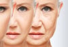 What You Need to Know First Before Contacting Your Nearest Botox Alpharetta Clinic!