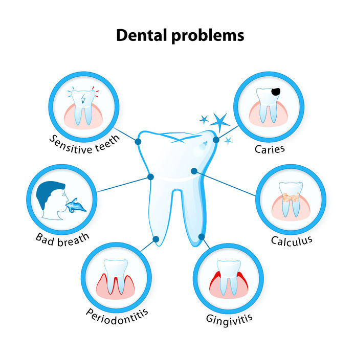 oral health problems