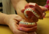 tooth decay