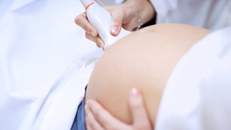 Ultrasound During Pregnancy