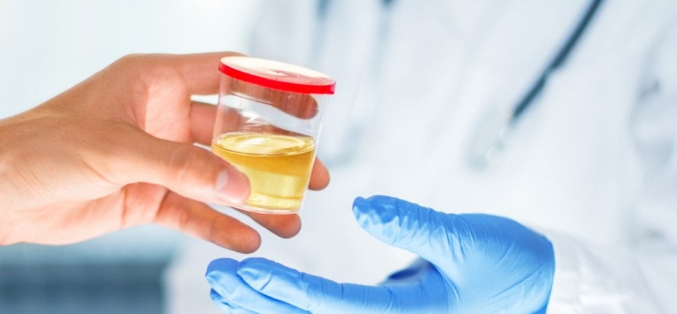 How To Use Synthetic Urine For A Drug Test
