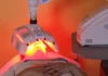 Photodynamic Therapy (PDT) Advancements – More Precise, Non-Invasive Light-Based Skin Cancer Treatments