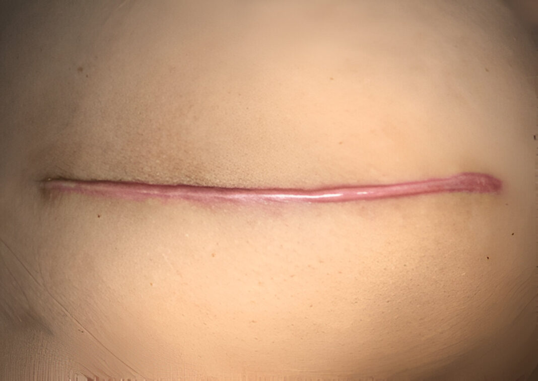 steptodown.com986087