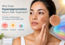 Why Does Hyperpigmentation Return After Treatment? The Role of Inflammation, UV Exposure and Visible Light